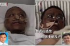 ویروس کرونا پوست بدن دو پزشک چینی را سیاه کرد