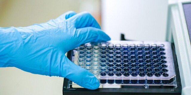 جدیدترین راهکار دانشگاه استنفورد برای پاسخ به ۲ سوال مهم درباره کووید-۱۹ جدیدترین راهکار دانشگاه استنفورد برای پاسخ به ۲ سوال مهم درباره کووید-۱۹