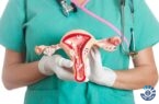 روش حفظ باروری در زنان دارای سرطان تخمدان